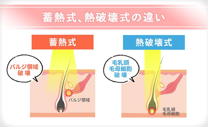 蓄熱式と熱破壊式の違いまとめ