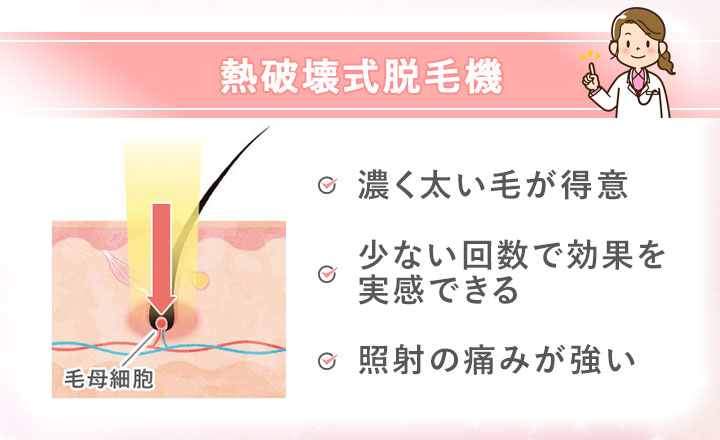 【熱破壊式】濃く太い毛が得意、少ない回数で効果を実感できる、照射の痛みが強い