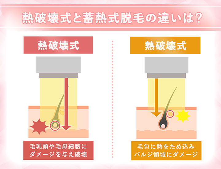 熱破壊式と蓄熱式の違い