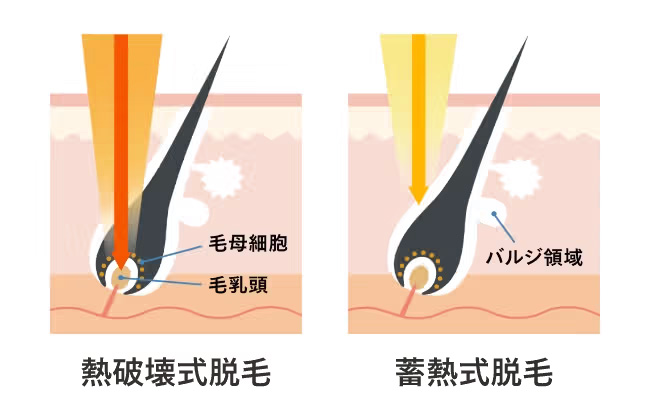 熱破壊式と蓄熱式の図説