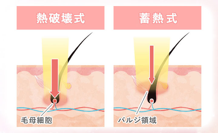 熱破壊式と蓄熱式の図説