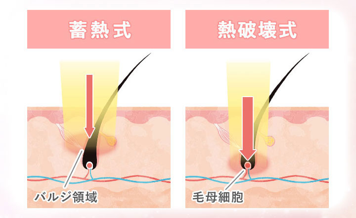 蓄熱式と熱破壊式の特徴のイラスト