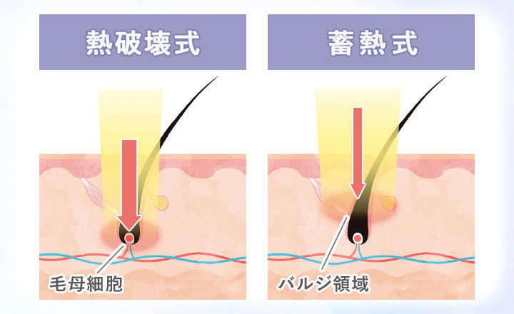 熱破壊式と蓄熱式の図説