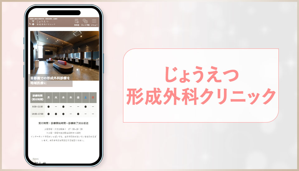 じょうえつ形成外科クリニックの公式サイトの画像