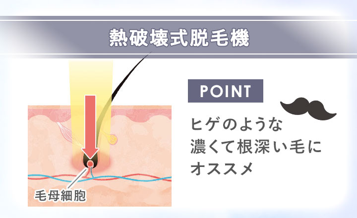 熱破壊式脱毛機の図説