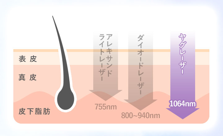 ヤグレーザーの照射深度の図説