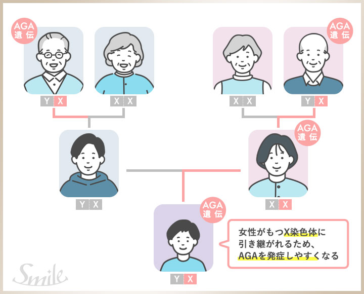 AGAの遺伝について父系、母系の遺伝の流れの図解