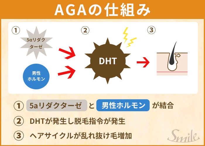AGAの仕組み