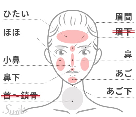 フレイアクリニックの顔脱毛の照射範囲