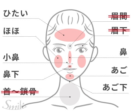 TCB東京中央美容外科の顔脱毛の照射範囲